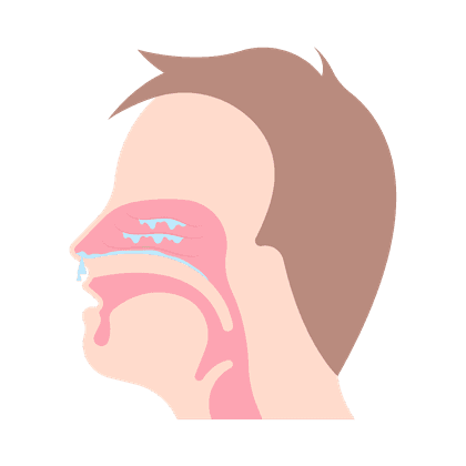 Sinusitis, voorhoofdsholteontsteking