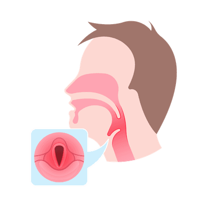 Faryngitis