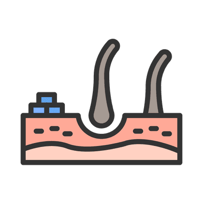 Seborroe
