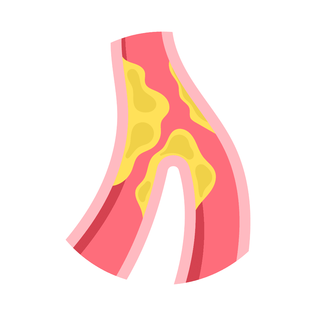 Atherosclerose