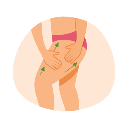 Cellulitis