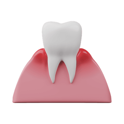 Tandvleesontsteking, gingivitis, parodontitis